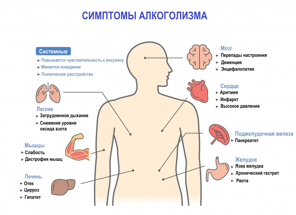 Похмелье — tdksovremennik.ru